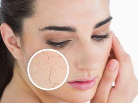 Sử dụng máy lạnh bị khô da - chia sẻ cách khắc phục